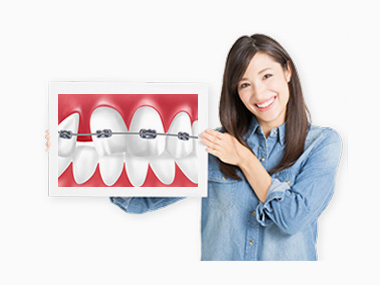 部分的な矯正治療で歯並びを整えられるかもしれません