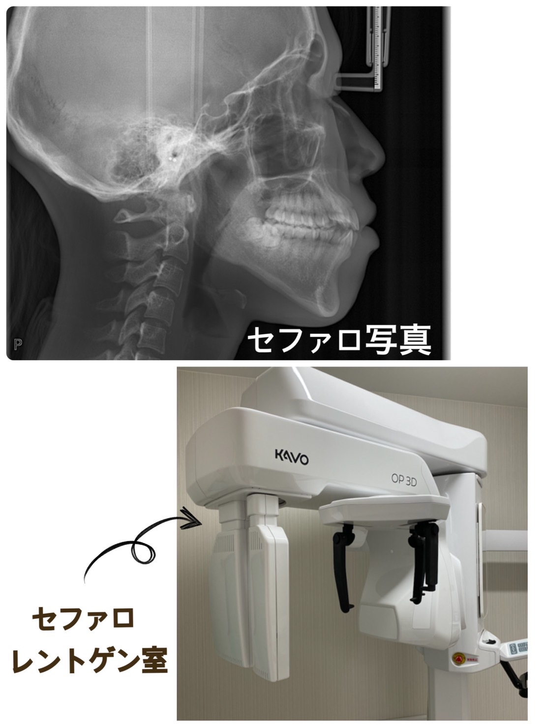 矯正検査の内容とは