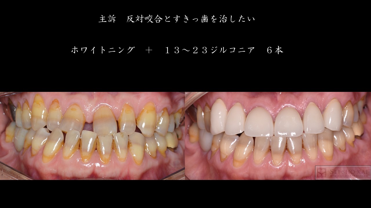審美補綴～Dental　Esthetic～