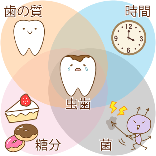 Newbrunの4つの輪って知ってる？